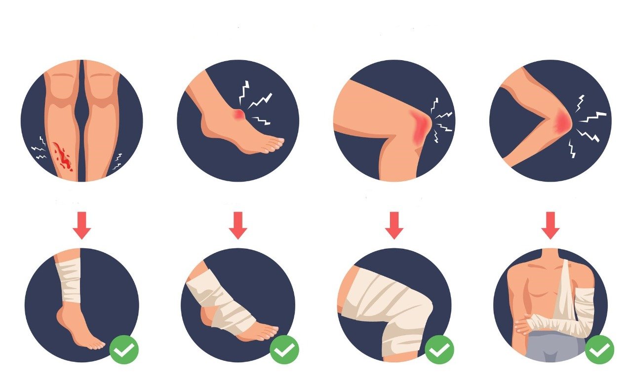 tipos-de-lesiones